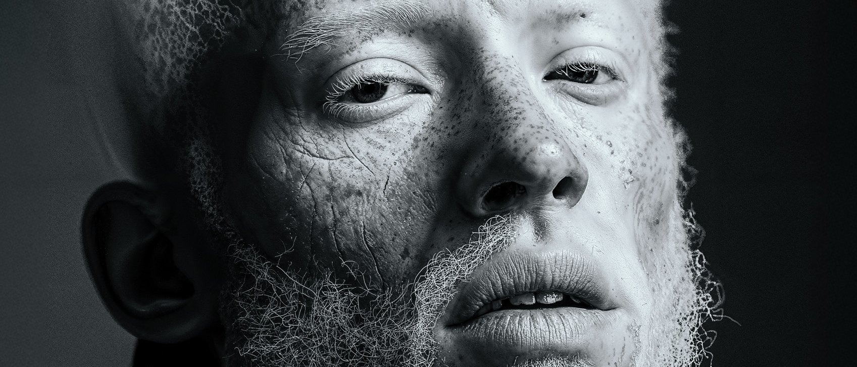 Close-up portrait of a person with fair skin, textured white hair and beard and freckles, looking slightly upwards with a neutral expression against a dark background.